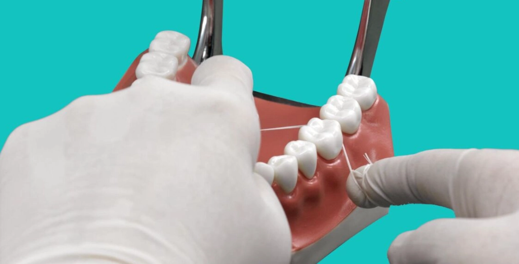 牙線使用時機 牙線使用時機