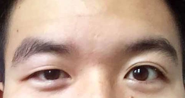 男人大小眼面相全解析：性格、運勢與實用改善指南