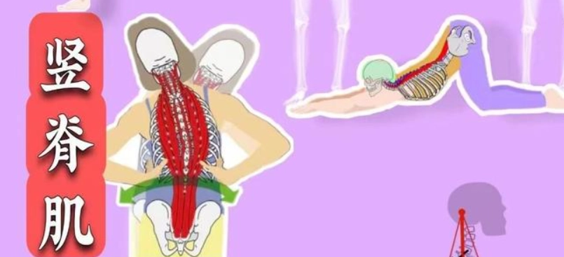 豎脊肌拉傷症狀全解析：從疼痛到康復的完整指南