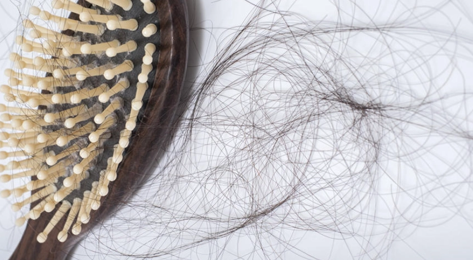 脫髮原因