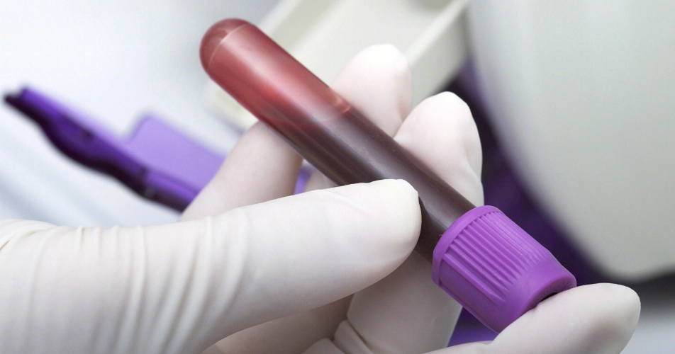 抽血檢查過敏原