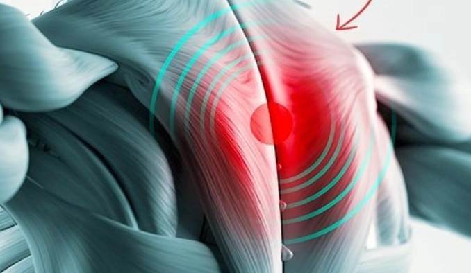 上背部疼痛原因