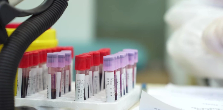 抽血檢查過敏原