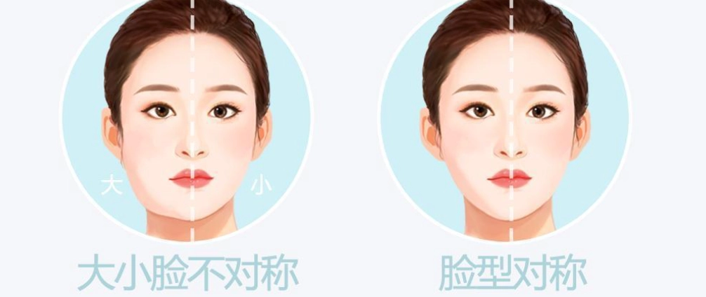 臉部不對稱治療