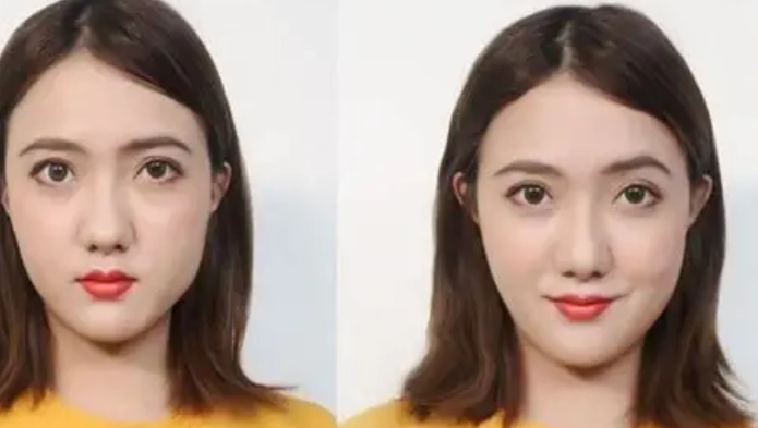 改善臉型不對稱