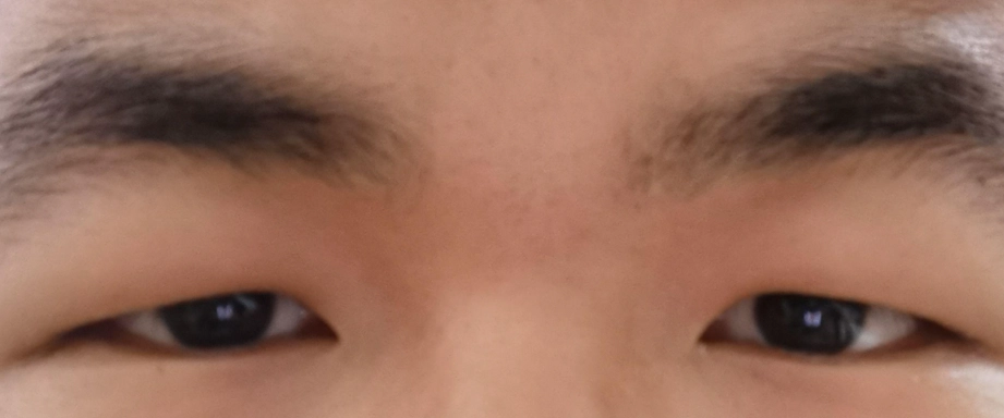 長大後眼睛變小原因與改善方法全解析