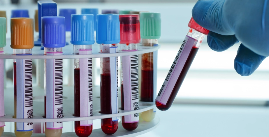 皮膚病抽血項目