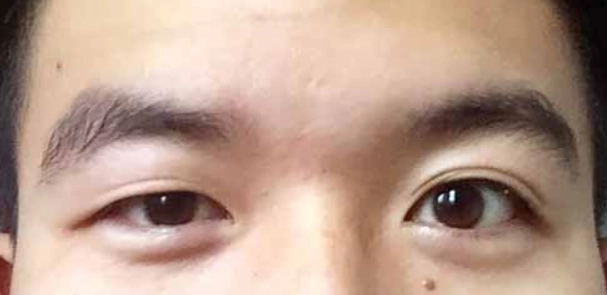 大小眼化妝技巧