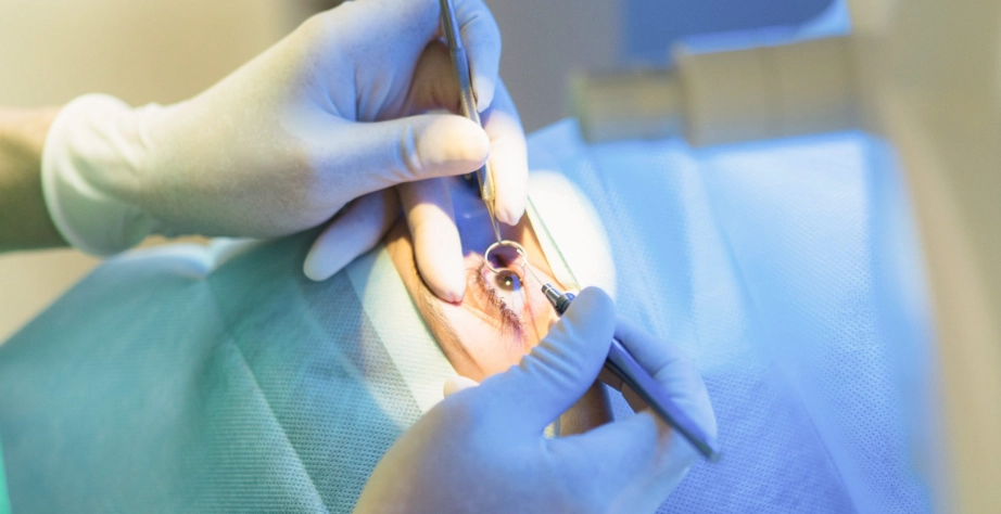 雷射近視恢復期症狀