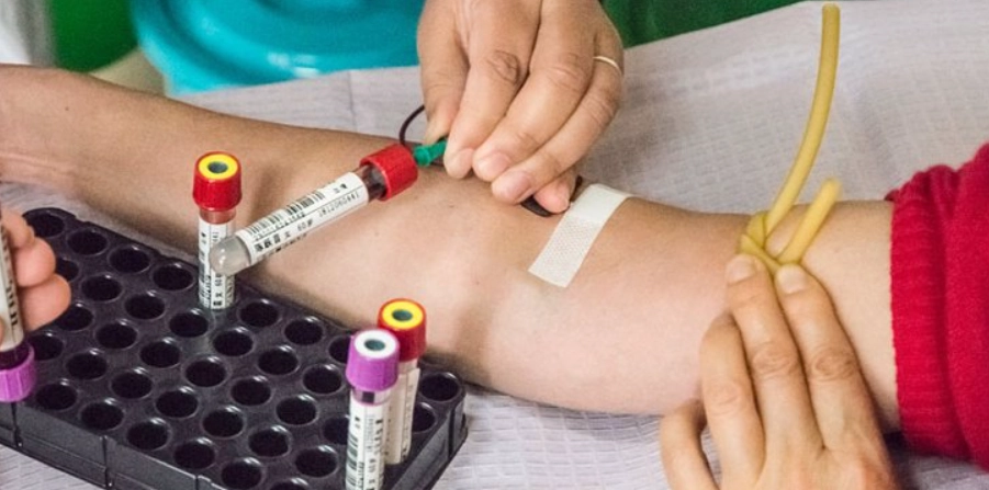 皮膚病抽血項目