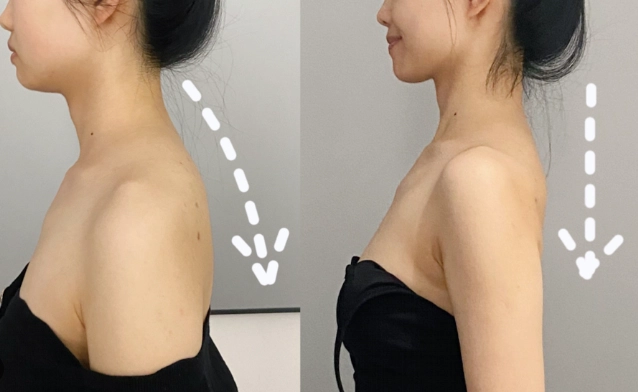 厚背減肥15天見效