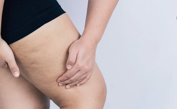 瘦大腿內側運動