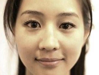 右眼大左眼小原因