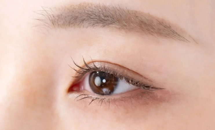 眼睛不對稱改善