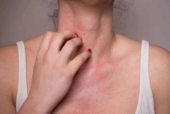 過敏性鼻炎 過敏性鼻炎