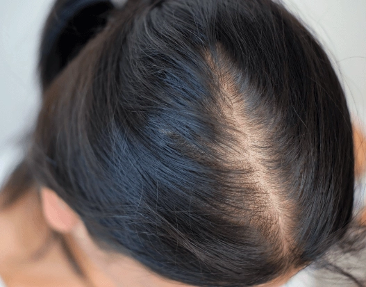 頭皮檢測診所