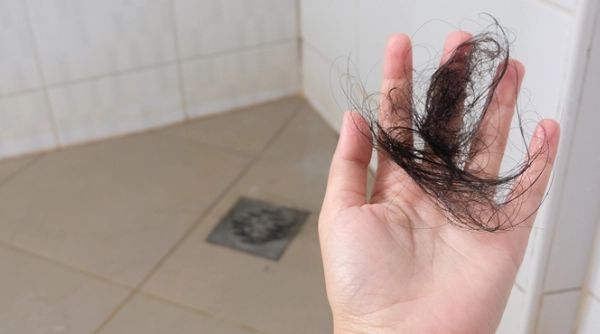 洗頭髮掉髮量多少算正常？完整解析掉髮原因與改善對策