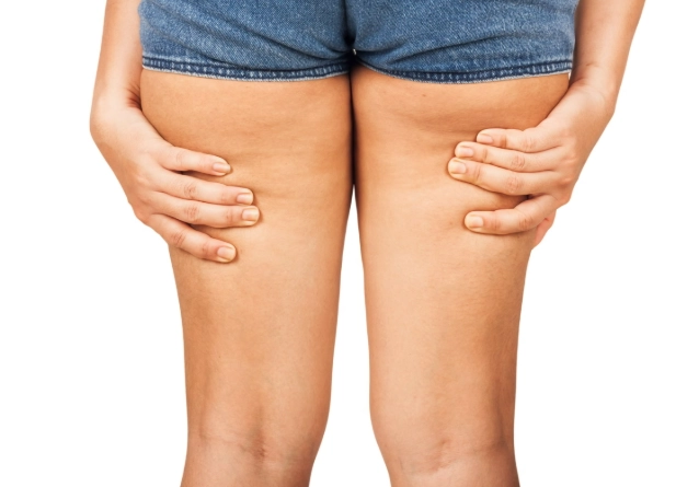 脂肪腿怎麼瘦？3個有效方法與飲食運動全攻略