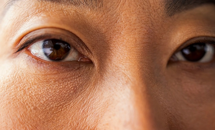 右眼大左眼小原因