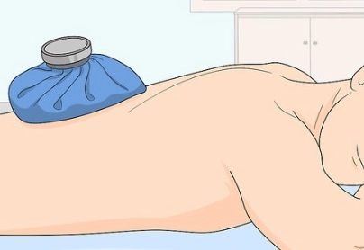 闊背肌拉傷處理