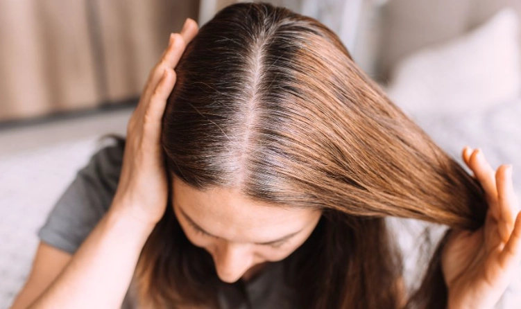 女性禿頭門診推薦