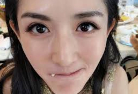 改善眼睛不對稱方法