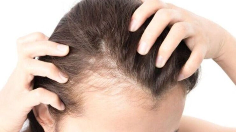 髮量稀疏怎麼辦