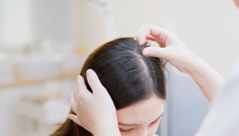 髮量稀疏怎麼辦