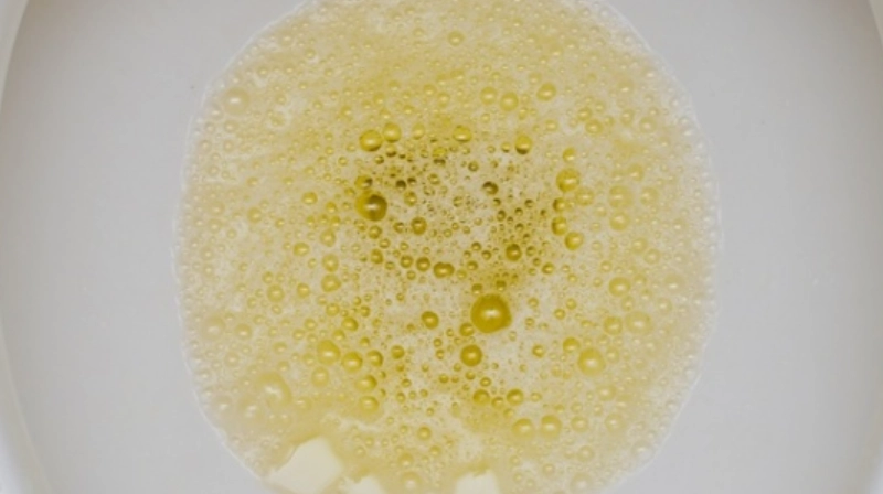 蛋白尿飲食禁忌