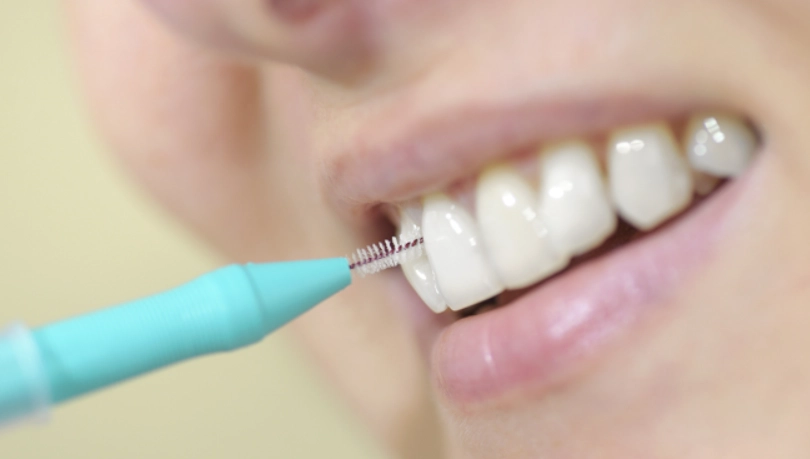 牙間刷更換頻率