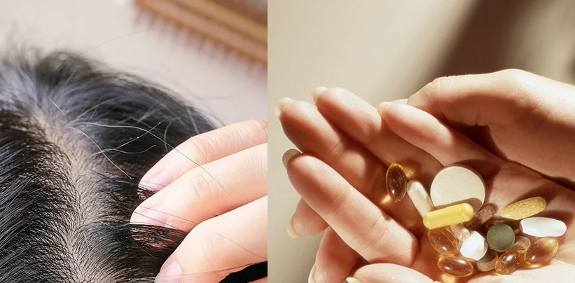 掉髮補充維他命