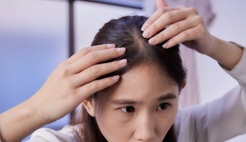 中醫生髮治療 中醫生髮治療