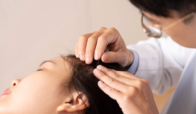 掉髮中醫 掉髮中醫