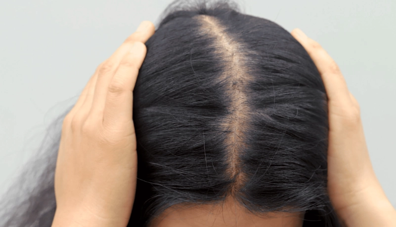 頭髮變細怎麼辦