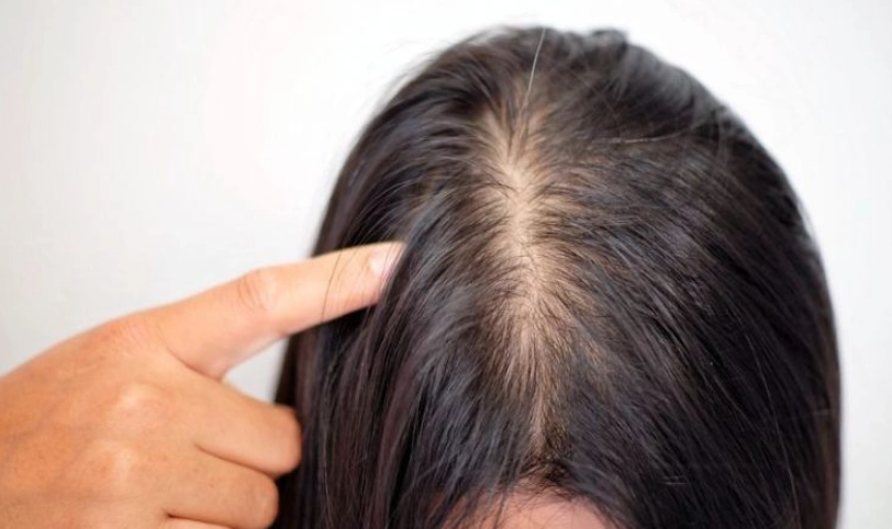 頭髮變細吃什麼