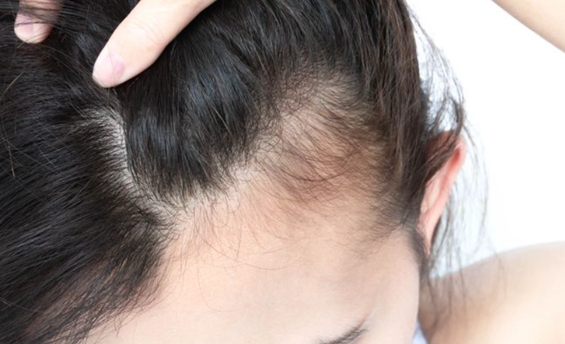 頭髮變細怎麼辦