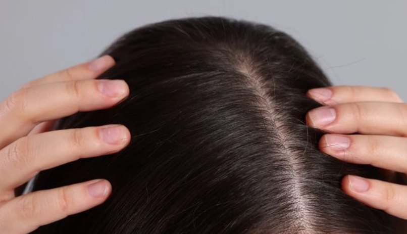 頭髮變細原因