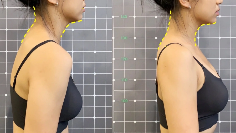 斜方肌直角肩訓練全攻略：從零到有的雕塑技巧與常見陷阱