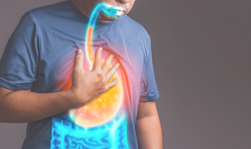 胃食道逆流 人蔘 胃食道逆流 人蔘