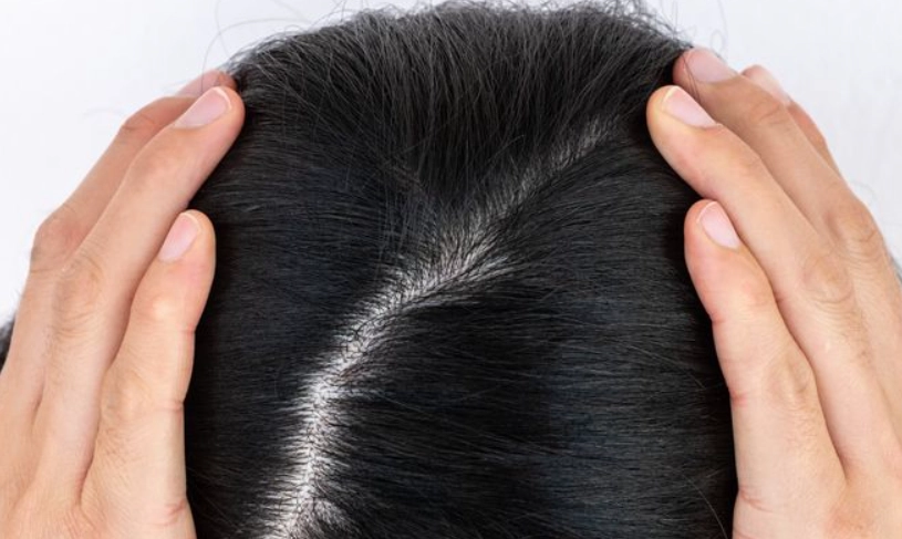 掉髮原因