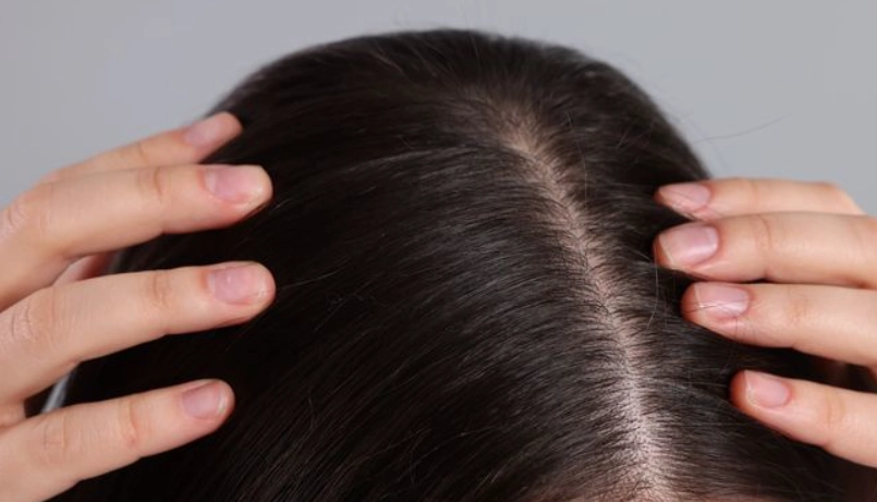 頭髮變細怎麼辦