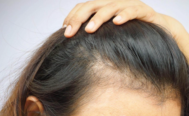 頭髮變細怎麼辦