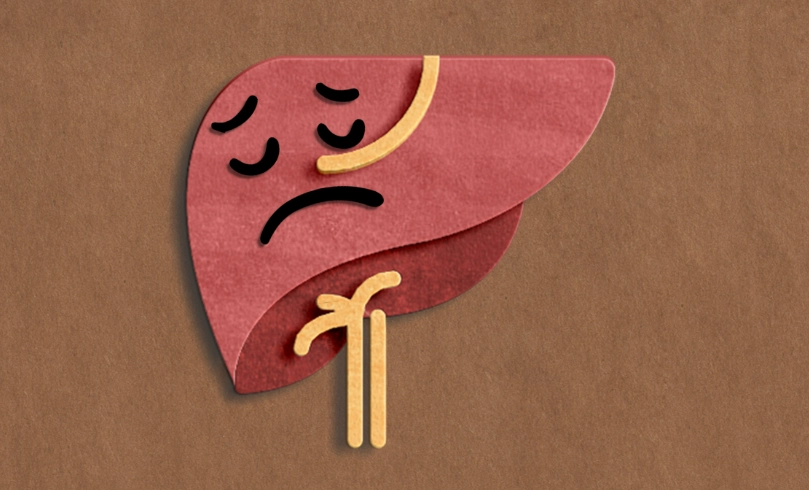 脂肪肝飲食指南