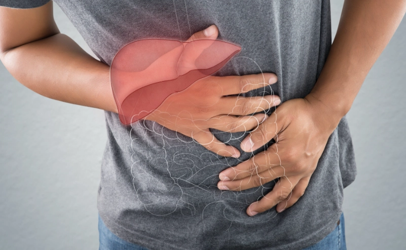 脂肪肝逆轉方法