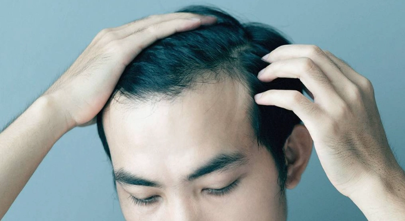 落髮年齡 落髮年齡