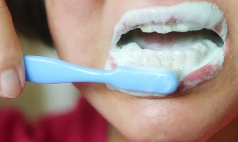 牙菌斑刷不掉原因 牙菌斑刷不掉原因