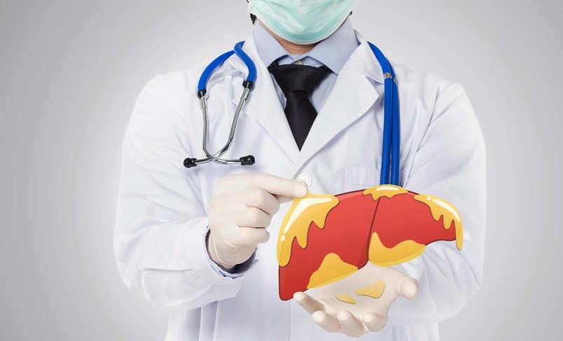 脂肪肝 治療 脂肪肝 治療