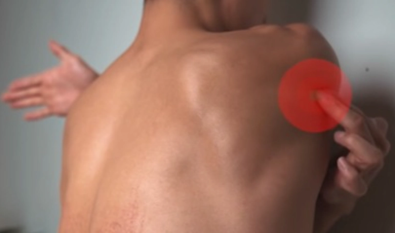 圓肩肱骨前移是什麼？物理治療師教你3步驟自我檢測與有效矯正運動