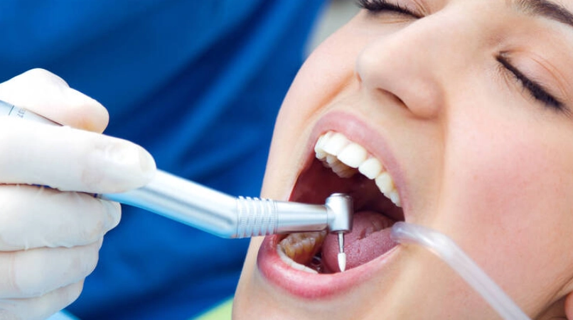 洗牙方法完整指南：專業牙醫親授正確清潔技巧