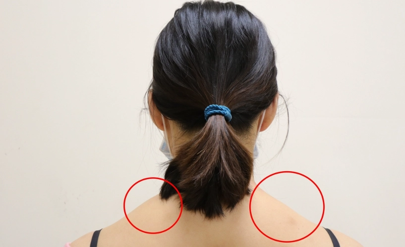 上斜方肌發炎症狀全解析：識別疼痛根源與有效舒緩方法